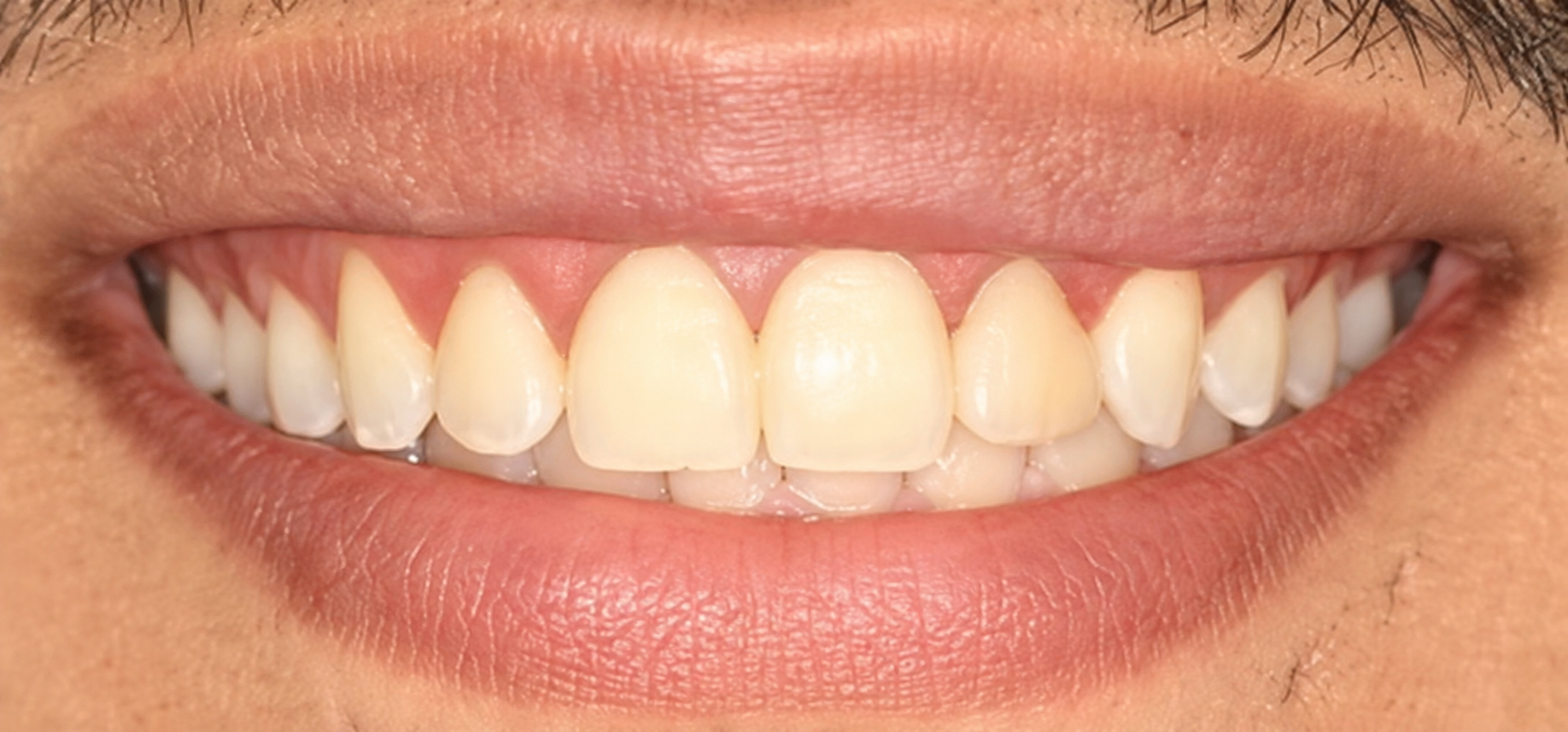 Smile Gallery